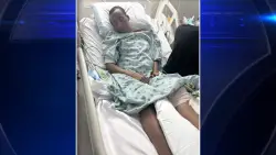Family seeks justice for woman injured in NW Miami-Dade hit-and-run amid search for driver